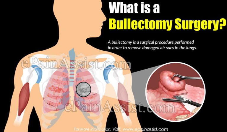 Bullectomy Surgery & Different Medical Conditions In Which Bullectomy Is Performed