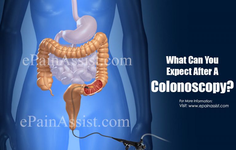What Can You Expect After A Colonoscopy?