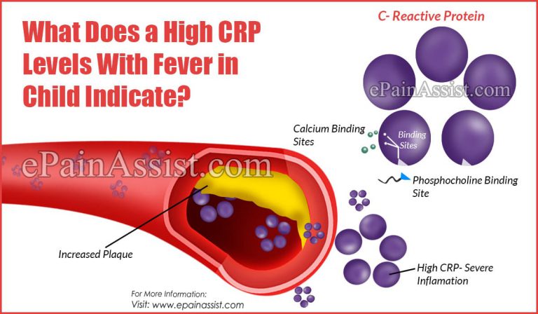 What Does a High CRP Levels With Fever in Child Indicate?