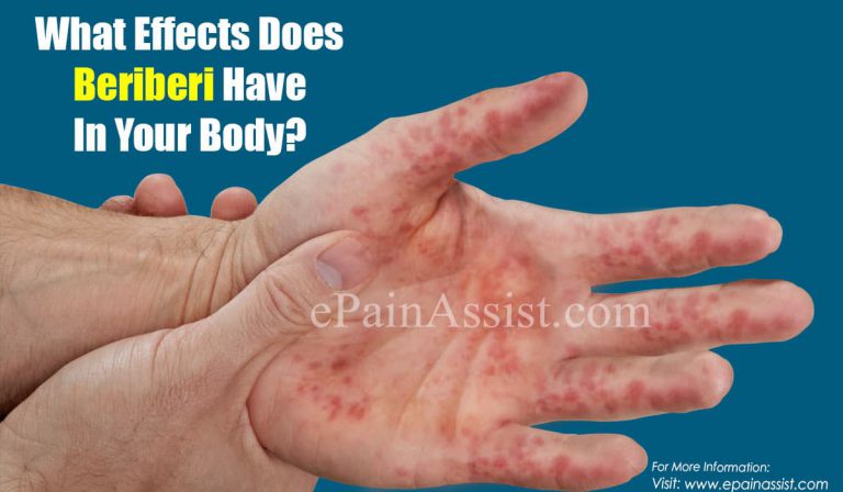 What Effects Does Beriberi Have In Your Body & Can Beriberi Be Cured?