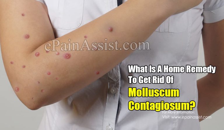 What Is A Home Remedy To Get Rid Of Molluscum Contagiosum?