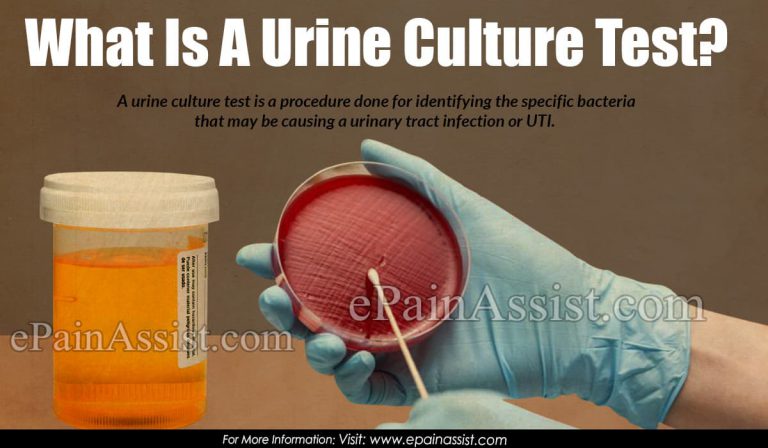 What Is A Urine Culture Test, Why Is It Done, What Does It Indicate?