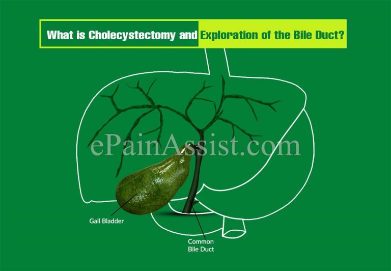 Cholecystectomy and Exploration of the Bile Duct