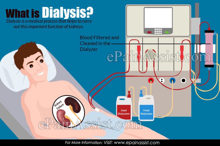 What is Dialysis & How Does it Work?