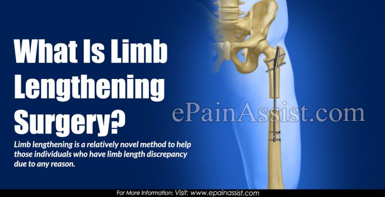 What Is Limb Lengthening Surgery?