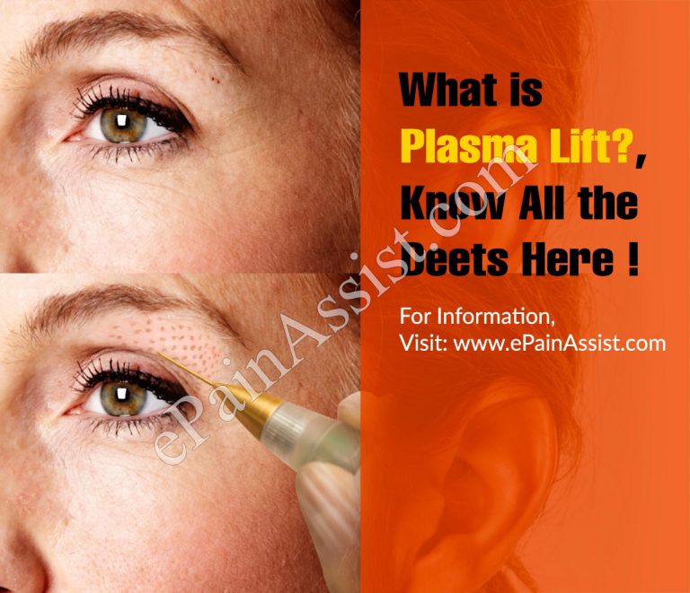 What is Plasma Lift: Know All the Deets Here !
