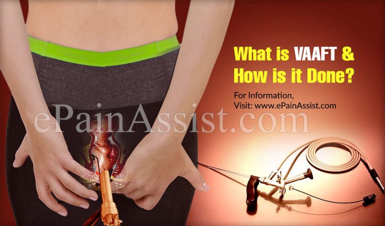 What is VAAFT & How is it Done?