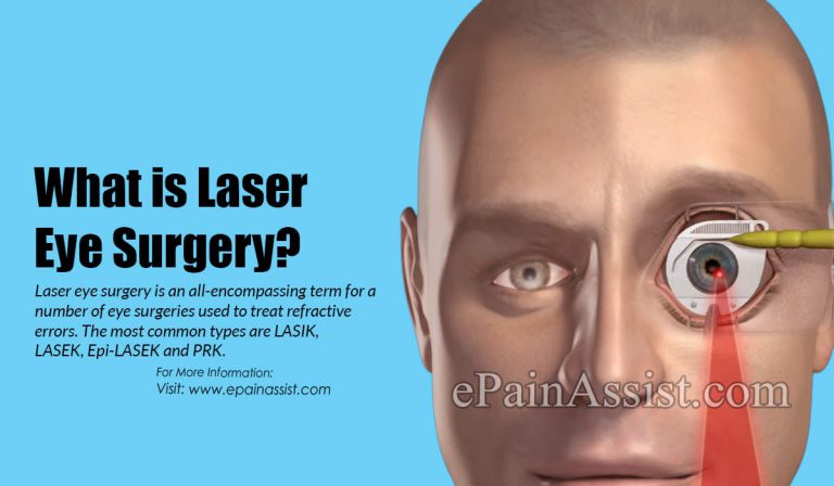 When Should One Get Laser Eye Surgery Done & What are the Precautions to Take After A Laser Eye Surgery?