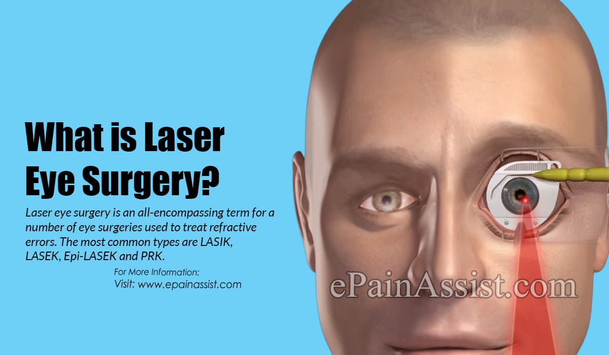 What is Laser Eye Surgery?