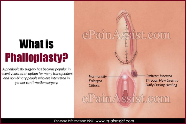 Understanding Phalloplasty: Surgical Techniques, Complications, Recovery