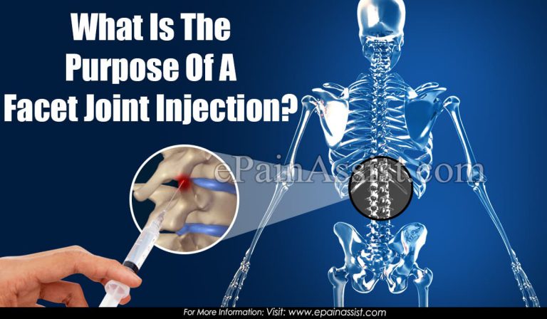 Purpose of Facet Joint Injection & How is it Performed?