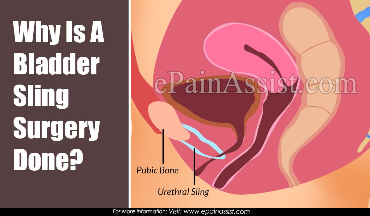 Why Is A Bladder Sling Surgery Done?