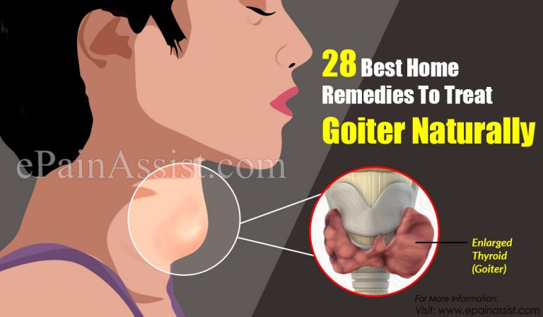 28 Best Home Remedies To Treat Goiter Naturally
