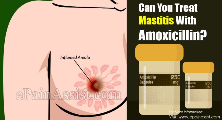 Can You Treat Mastitis With Amoxicillin?