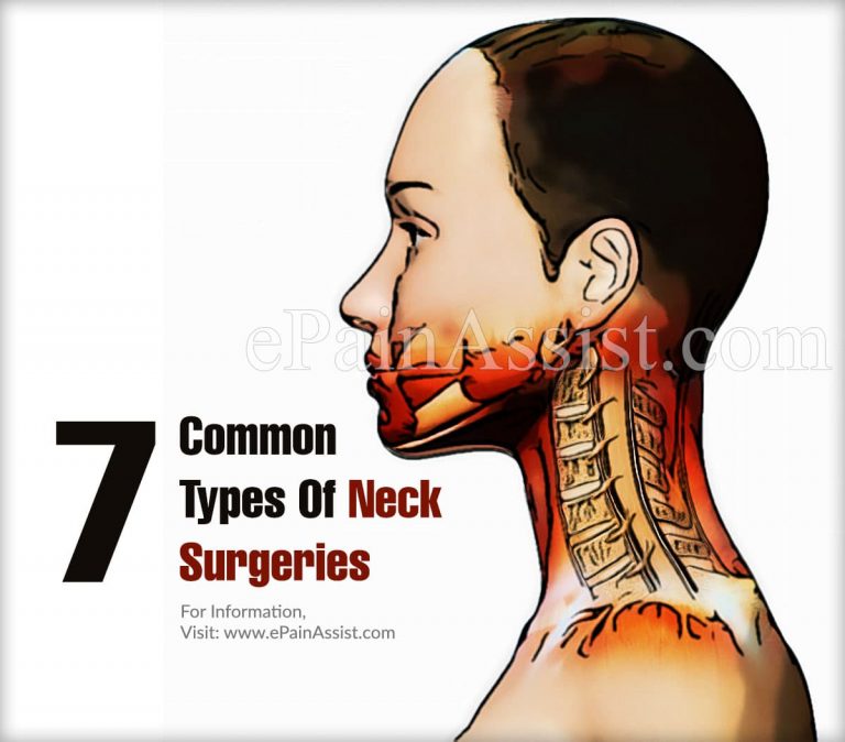 7 Common Types of Neck Surgeries, Recovery Period and the Risks Involved in Neck Surgery