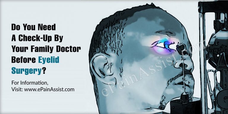 Do You Need A Checkup By Your Family Doctor Before Eyelid Surgery?