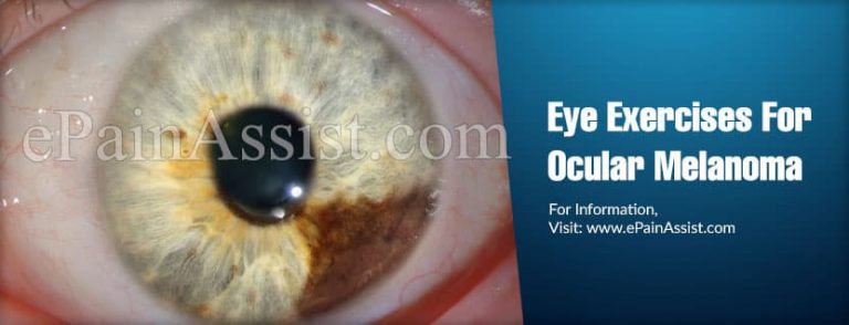 Eye Exercises/Yoga For Ocular Melanoma