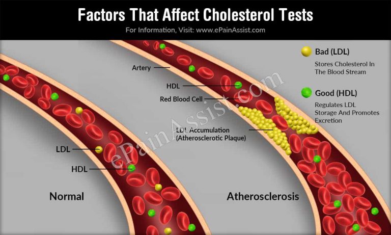 Factors That Affect Cholesterol Tests