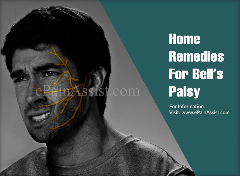 Home Remedies For Bell’s Palsy & How Common Is It?