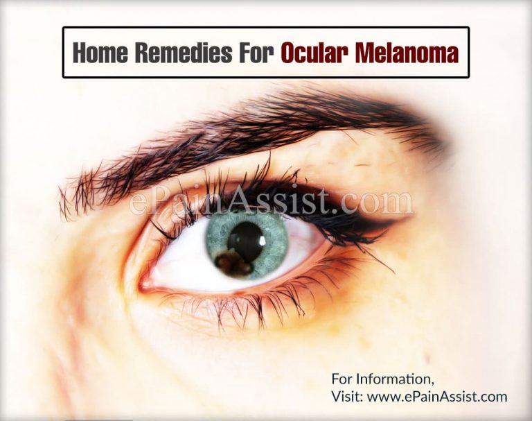 Home Remedies For Ocular Melanoma