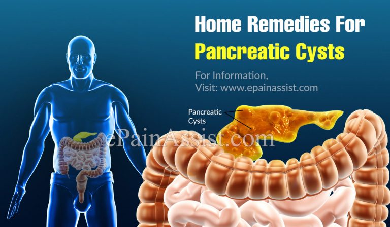Home Remedies For Pancreatic Cysts