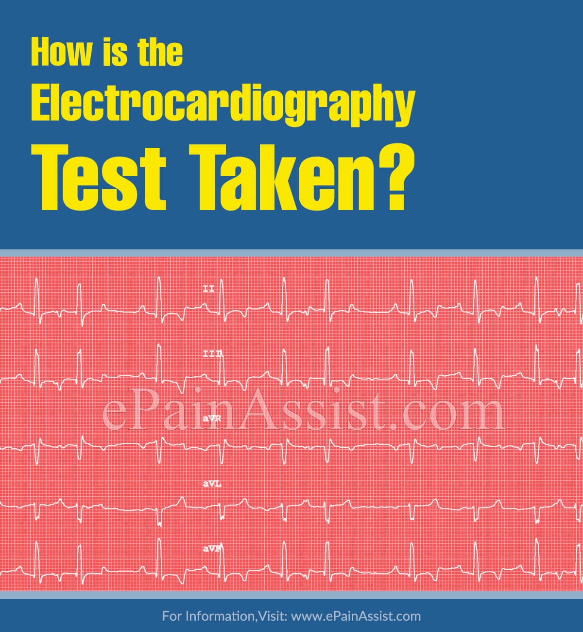 How is the Electrocardiography Test Taken?