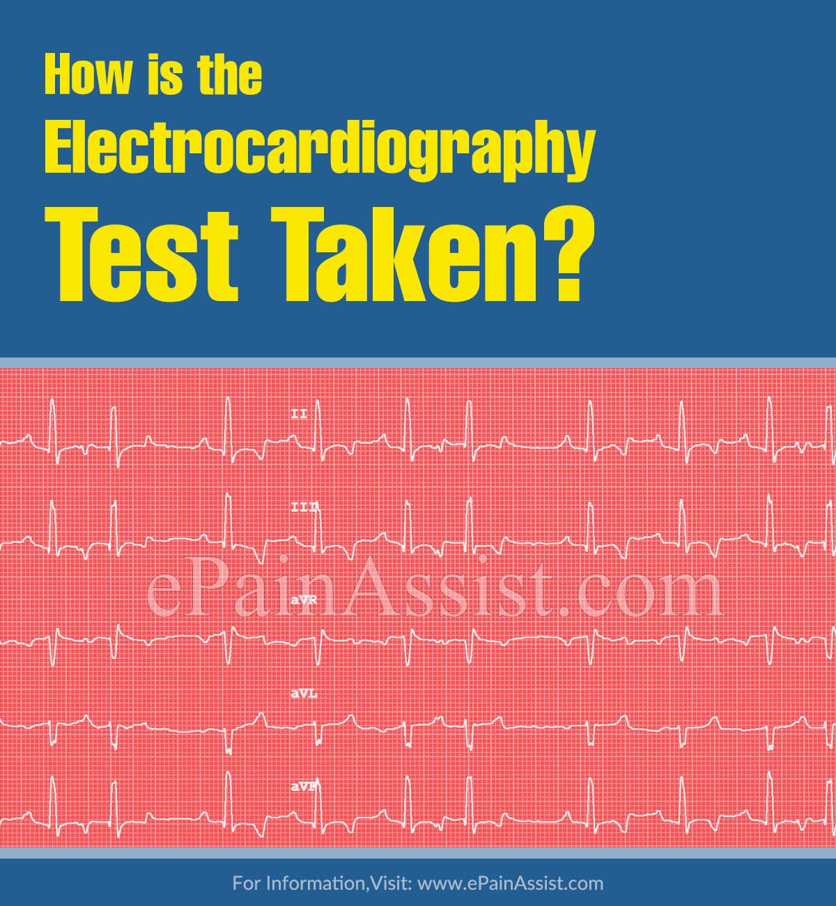 How is the Electrocardiography Test Taken?