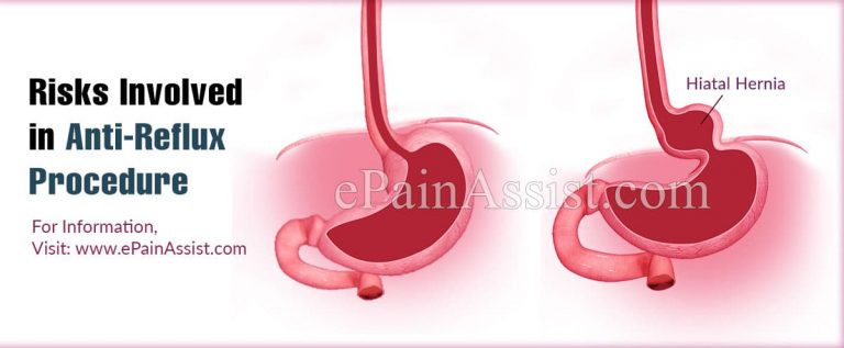 Anti-Reflux Procedures: Aim, Risks, Prognosis