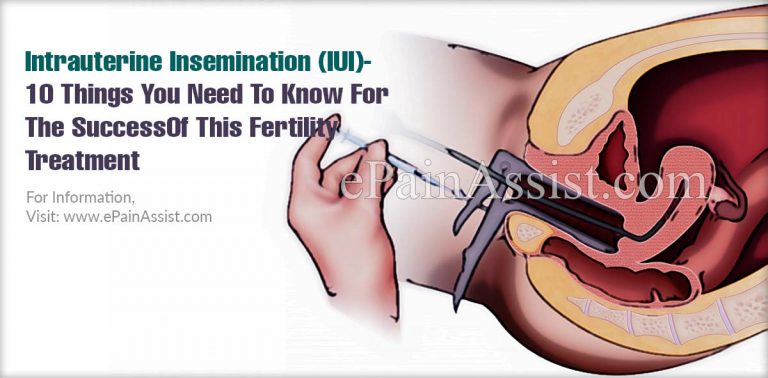 Intrauterine Insemination (IUI): 10 Things You Need To Know For The Success Of This Fertility Treatment
