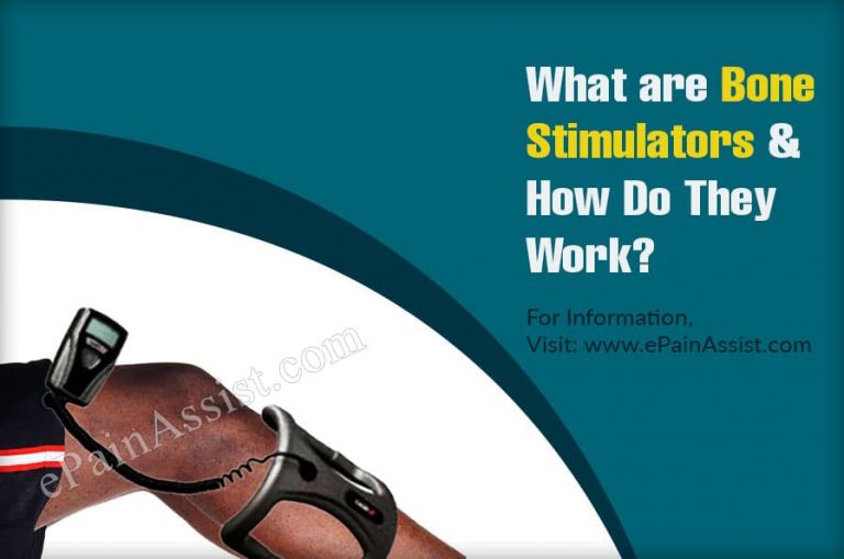What are Bone Stimulators & Do They Work?
