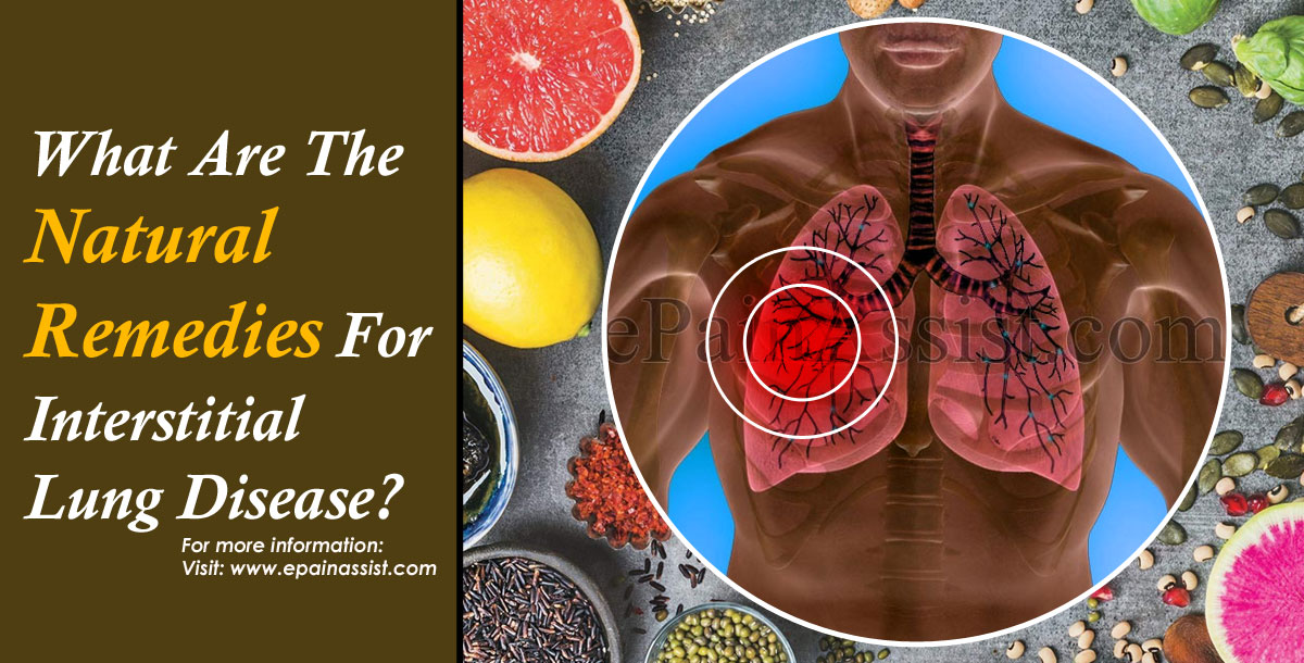 What Are The Natural Remedies For Interstitial Lung Disease?