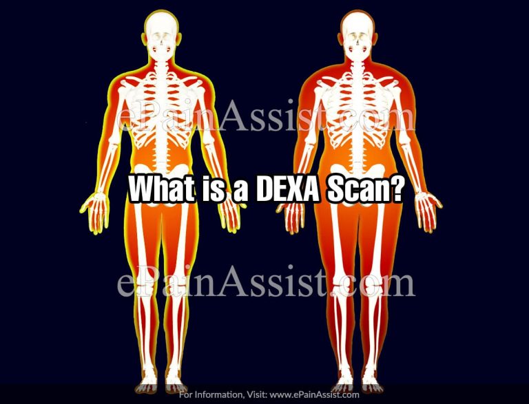 What is Dexa Scan & What is it Used For?