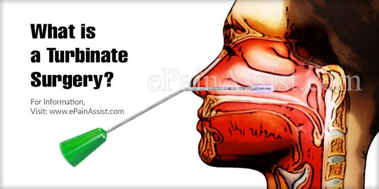 What is a Turbinate Surgery, Know its Types and Procedure