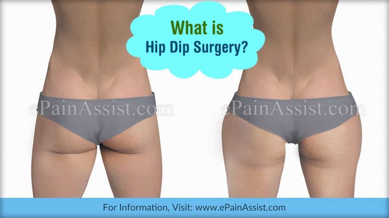 What is Hip Dip Surgery & How is it Done?| Who Can Go Ahead With The Hip Dip Surgery & Is it Safe?
