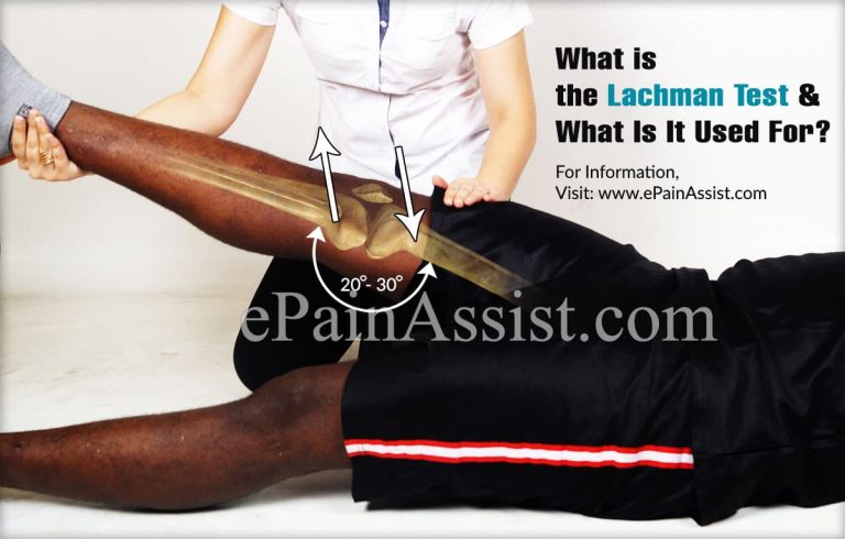 What is the Lachman Test & How Accurate is It?