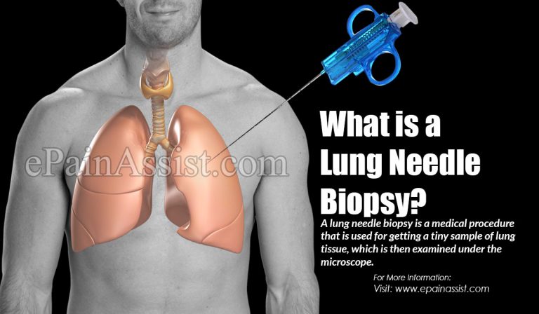 What to Expect in a Lung Needle Biopsy?