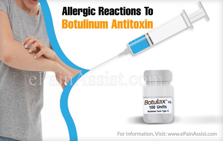Allergic Reactions to Botulinum Antitoxin