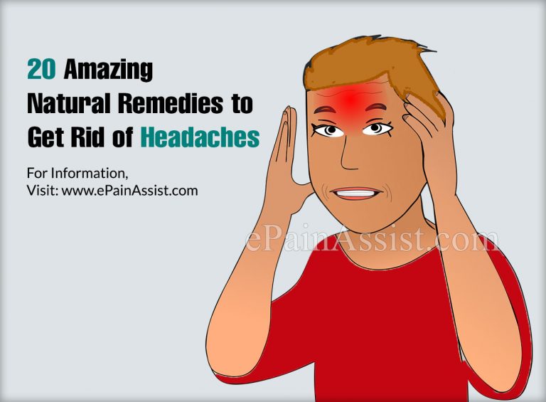 20 Amazing Natural Remedies to Get Rid of Headaches