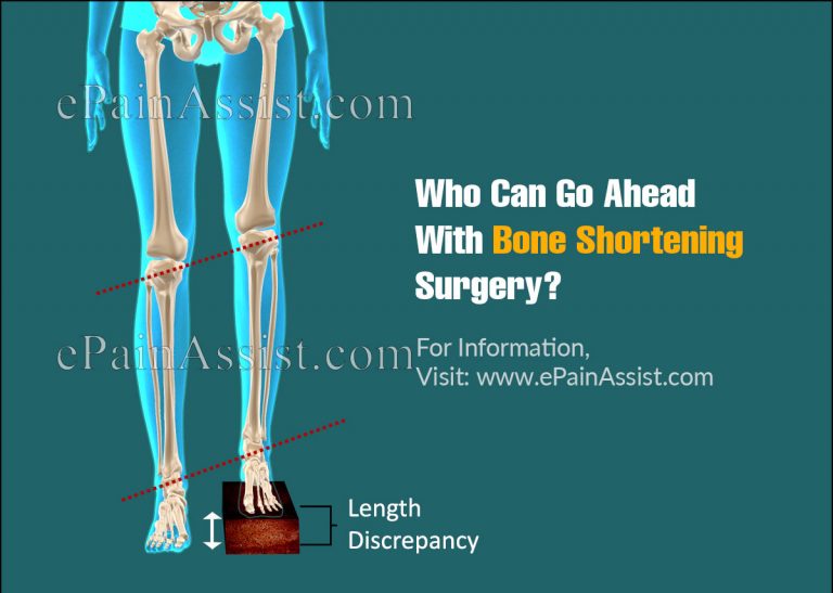 Bone Shortening Surgery: Procedure, Side Effects And Risks