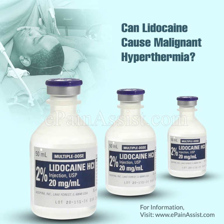 Can Lidocaine Cause Malignant Hyperthermia?