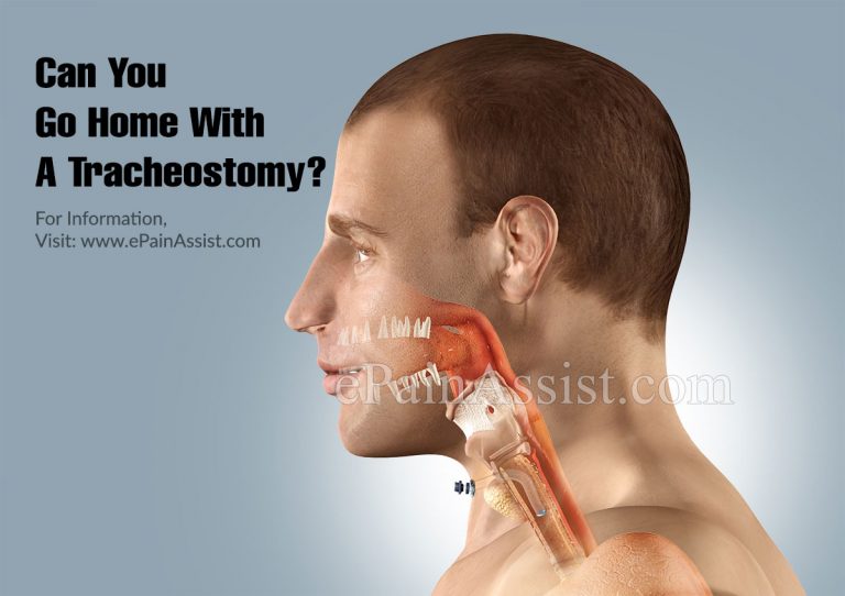 Can You Go Home With A Tracheostomy & Is A Tracheostomy Better Than A Ventilator?