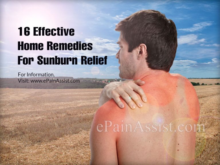 16 Effective Home Remedies For Sunburn Relief