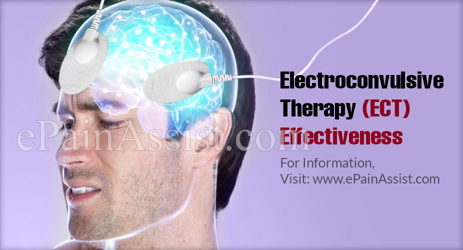 Electroconvulsive Therapy (ECT) Effectiveness