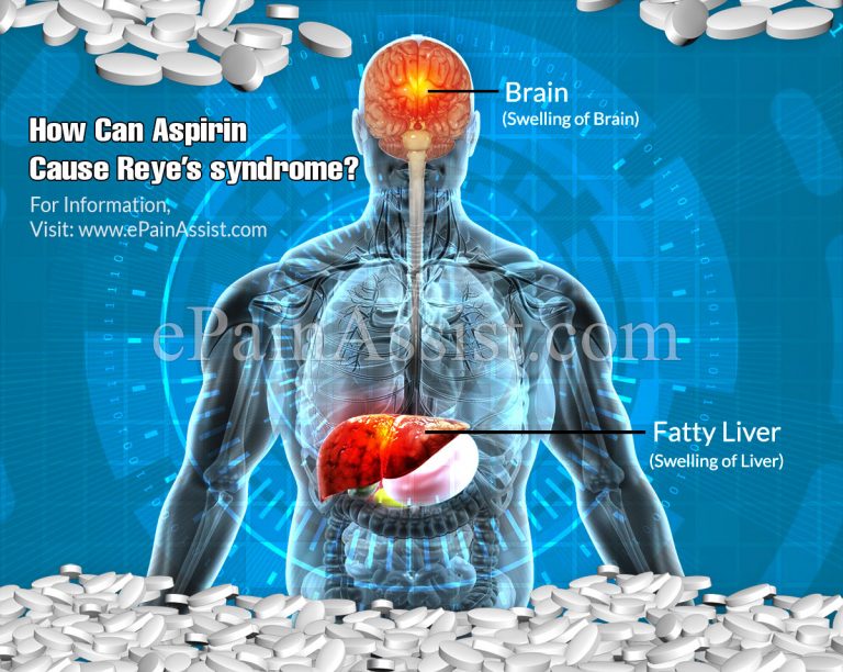 How Can Aspirin Cause Reye’s syndrome?