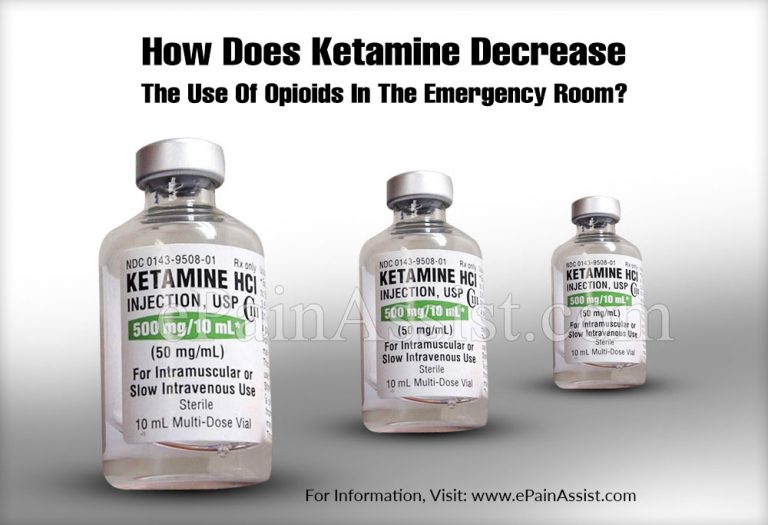 How Does Ketamine Decrease The Use Of Opioids In The Emergency Room?