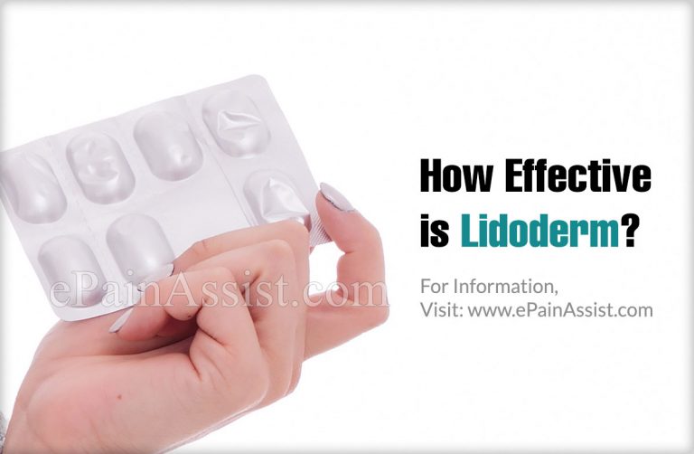 How Effective is Lidoderm & What are It’s Side Effects?