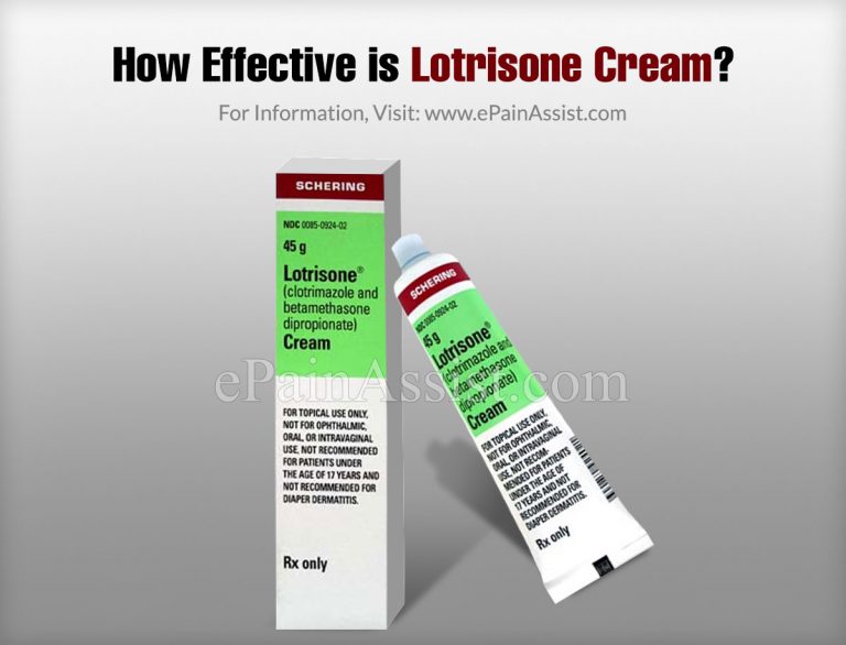 How Effective is Lotrisone Cream & What are It’s Side Effects?