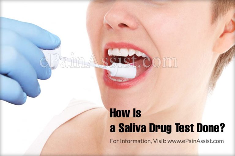 How is a Saliva Drug Test Done & What Can It Detect?
