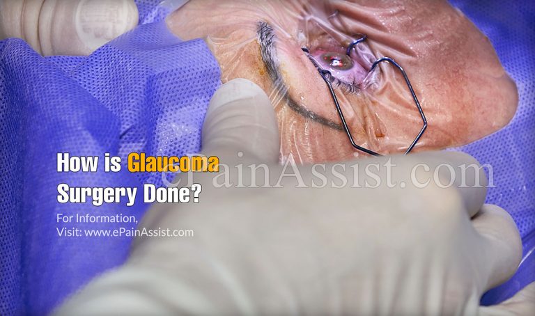 How is Glaucoma Surgery Done?