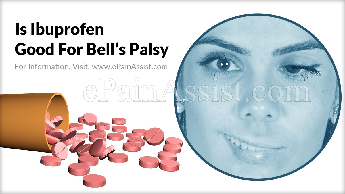 Is Ibuprofen Good For Bell's Palsy?